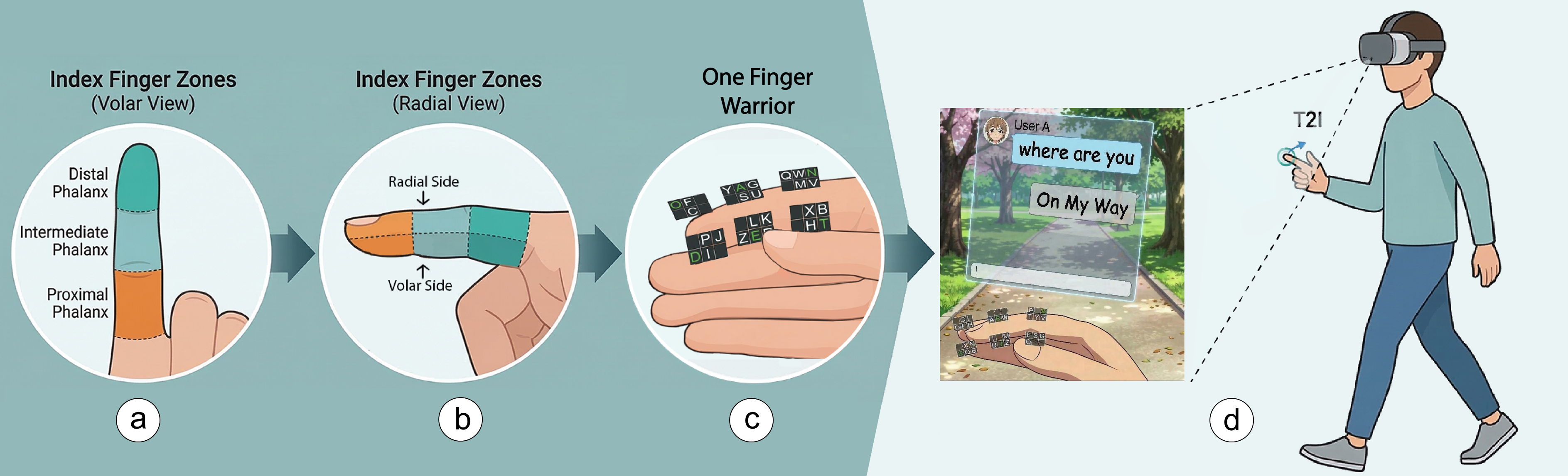 (a) Index Finger can be divided into three segments along the longitudinal axis: Distal Phalanx, Intermediate Phalanx, and Proximal Phalanx. Similarly, (b) the surface of the index finger can be divided into Radial (top) and Volar (front) surfaces along the transverse axis. (c) Combining these, we can have six regions: (i) Radial Distal, (ii) Radial Intermediate, (iii) Radial Proximal, (iv) Volar Distal, (v) Volar Intermediate, and (vi) Volar Proximal. We use these regions to design One Finger Warrior: a one-finger keyboard. (d) An example scenario where a user is replying to a message on-the-go using One Finger Warrior.